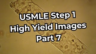 USMLE Step 1 High Yield Images Part 7 [upl. by Jemina]