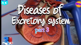 Excretory System Diseases Understanding the Impact on our Health  Class 11 Biology neet biology [upl. by Kcirdde822]