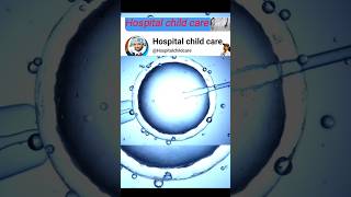 IVF procedure shorts ytshorts ivf procédure viralvideo hospitalchildcare [upl. by Elana]