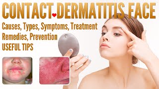 Contact Dermatitis Face Causes Types Symptoms Treatment Prevention Home Remedies [upl. by Cruz]