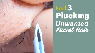 PART 3  Plucking Unwanted Facial Hair  Womens Beard Removal Tweezers  PCOS Warrior [upl. by Arlyne]