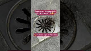 Say goodbye to clogged shower drains and hair loss with Musely hair loss treatments  100 online [upl. by Engen96]