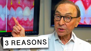 3 Reasons Your Gums Are Inflamed and How to Treat at Home 🦷🔥 [upl. by Ruenhs]