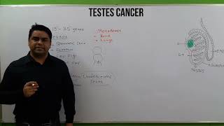 Testes Cancer  Sign amp Symptoms  Diagnosis  Causes  Medical Management  Nursing Care  NCLEX [upl. by Nonnerb314]