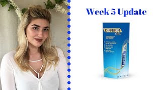 Differin Gel Retinoid Treatment  Week 5 Update [upl. by Aggappe]