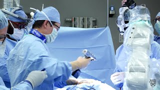 Mayo Clinic Minute How awake spinal surgery benefits patients [upl. by Garceau]