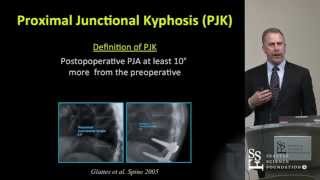 Proximal Junctional Kyphosis and Failure by Darrel S Brodke MD [upl. by Haila]