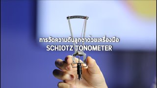 การวัดความดันลูกตาด้วย Schiotz tonometer [upl. by Haggar]