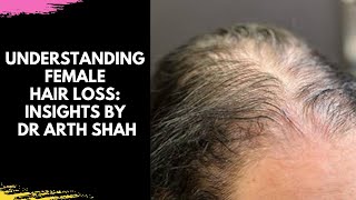 Understanding Female Hair Loss Insights by Dr Arth Shah [upl. by Sheeree]