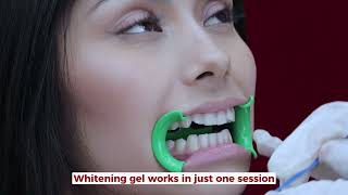 How do we do our teeth whitening [upl. by Gluck]