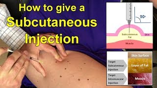 How to Give a Subcutaneous Injection Video [upl. by Mariette]