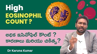 Reasons for High Eosinophil Counts  How to Reduce Eosinophils  Dr Karuna Kumar Hematologist [upl. by Reeva6]