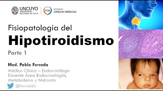 Fisiopatología del hipotiroidismo Dr Ferrada Parte 1 [upl. by Coralie573]