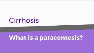 Cirrhosis – What is a paracentesis [upl. by Bennie866]