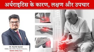 अर्थराइटिस गठिया Arthritis  लक्षण कारण इलाज उपाय  Dr Rachit Gulati  SAAOL Ortho Care [upl. by Eerolam]