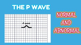 ECG P wave [upl. by Rosenwald879]