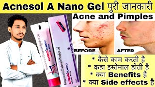 Acnesol A Nano Gel Uses  Adapalene amp Clindamycin Gel  Dose  Side Effects  Precautions in hindi [upl. by Nah557]