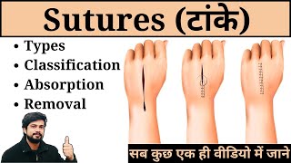 Sutures  Types Classification Removal and Absorption in Hindi  Nursing  Surgery  Medical  GNM [upl. by Claudetta]