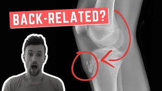 Why Osgood Schlatter Disease is BackRelated [upl. by Adorl230]