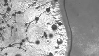 A colony of Dictyostelium devouring bacteria [upl. by Ciri]