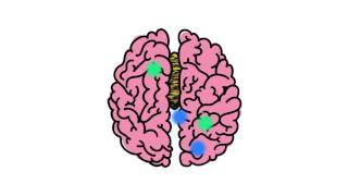 Understanding Disorders of the Corpus Callosum Animated Video by NODCC [upl. by Yerhcaz]