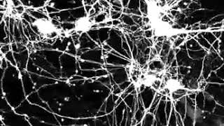 Neuron time lapse video [upl. by Renfred]