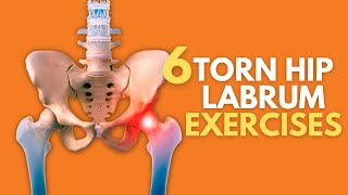 Top 6 Exercises For Naturally Healing A Painful Torn Hip Labrum [upl. by Pardoes]