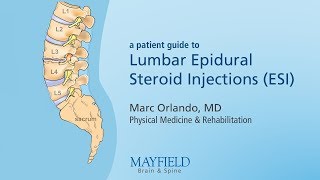 Lumbar Epidural Steroid Injections [upl. by Maccarthy]