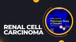 Renal cell carcinoma  Risk factors  Pathogenesis  Morphology  Clinical features [upl. by Anita]