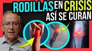 DOLOR DE RODILLA ¿CÓMO MANEJARLO Y QUÉ COMER [upl. by Czarra]