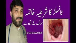 Tonsils ka Desi ilaj in Urdu  home Remedies for Tonsillitis [upl. by Ahsercal]