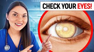 What Your EYES Say About your HEALTH Doctor Explains [upl. by June55]