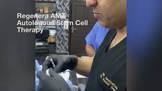 Regenera AMT autologous stem cell therapy for hair regeneration in Peshawar [upl. by Palua]