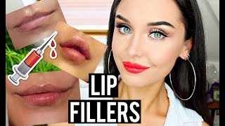 MY LIP FILLERS EXPERIENCE 💉 BEFORE AND AFTER JUVEDERM VOLIFT LIPS  KatesBeautyStation [upl. by Eisenhart]