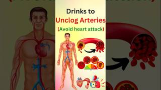 Drinks That CLEAR Your Arteries FAST [upl. by Andeee]