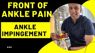 Simple Exercises to Fix Your Front of Ankle pain  Ankle Impingement [upl. by Tiebout718]