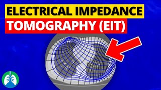 Electrical Impedance Tomography EIT  Quick Explainer Video [upl. by Barclay]