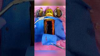 Pickle TWINS 😰Mom Flatlines During Emergency FruitSurgery Csection FoodSurgery DiscountDentist [upl. by Eselehs13]