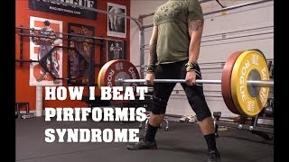 How I Beat Piriformis Syndrome  False Sciatica [upl. by Saeger]