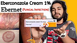 Ebernet Cream Review  Eberconazole Cream 1 For Ringworm Itching Fungal Infection [upl. by Leile]