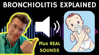 Doctor explains Bronchiolitis RSV with example of REAL SOUNDS  Respiratory syncytial virus [upl. by Lathrope]