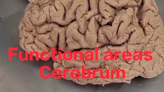 Functional areas of brain neuroanatomy cerebrum anatomy functional areas of cerebrum [upl. by Nirtak]