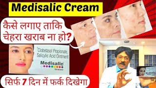 Medisalic cream Medisalic cream ke fayde  Medisalic Cream For Fairness  Safe or Not Review Hindi [upl. by Dhaf]