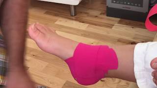 How to Apply Kinesiology Tape for Medial Ankle Sprain [upl. by Harutek]