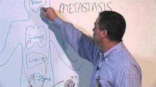 How Cancer Spreads Metastasis  Michael Henry PhD [upl. by Ramalahs882]