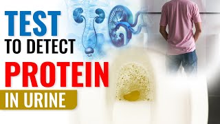 Test to detect Protein in Urine  Proteinuria Test [upl. by Nord]