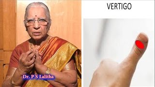 What is Vertigo Treatment  தலை சுற்றல் Headache  Cause of Vertigo  Reiki  DrP S Lalitha [upl. by Alehcim482]