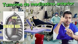 Tumores de mediastino anterior [upl. by Sherrer]