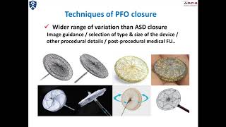 Introduction of PFO Closure [upl. by Hurd]