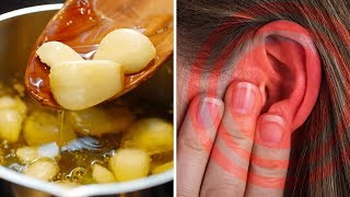 How to Make Garlic Oil Ear Drops for Ear Infections amp Ear Aches [upl. by Anawot]